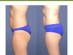 HealthXP™ Wormwood Detox Pads