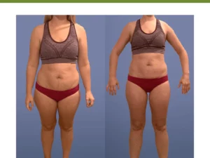 HealthXP™ Wormwood Detox Pads