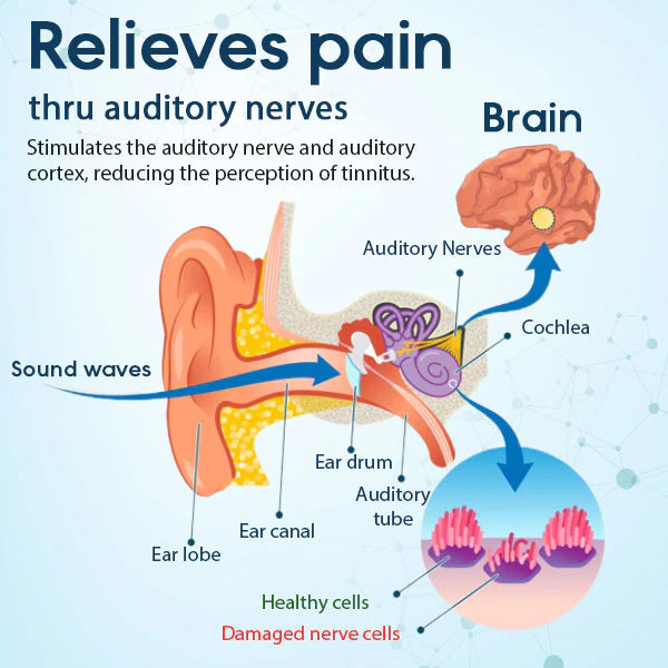 HearEase™ Tinnitus Linderung Behandlung Ohrpflaster