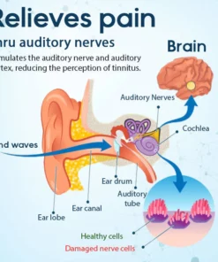 HearEase™ Tinnitus Linderung Behandlung Ohrpflaster