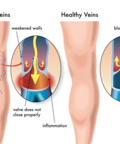 HeatWave™ Compression Knee Brace