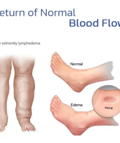 HeatWave™ Compression Knee Brace