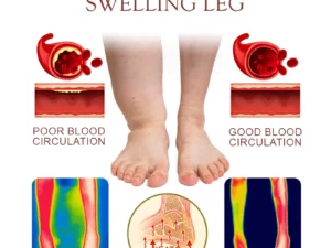 HerbCure BodyDetox LymphCleasing FootSoak