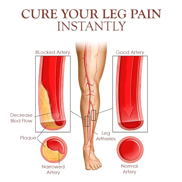 HerbCure BodyDetox Lymph Nadiifinta FootSoak