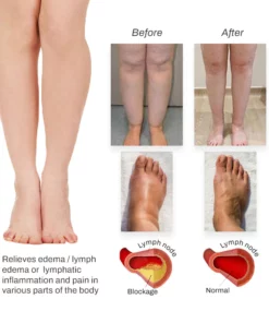 Herbalax Lymphvity BodyDetox FootPatch