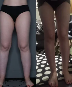 Herbalax Lymphvity BodyDetox FootPatch