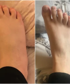 Herbalax Lymphvity BodyDetox FootPatch