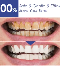 ISmile™ Bright Teeth Whitening Essence