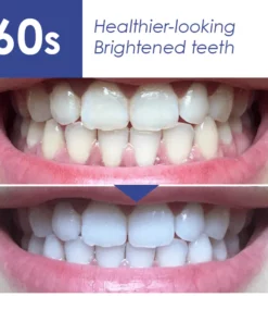 ISmile™ Bright Teeth Whitening Essence