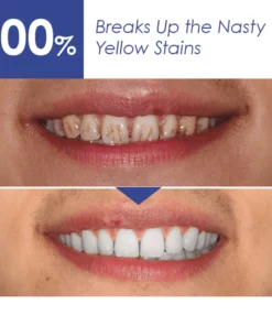 ISmile™ Bright Teeth Whitening Essence