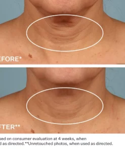 Instantly Ageless™ - Neck Firming & Anti-aging Cream