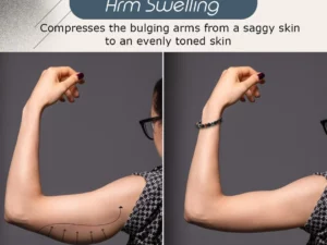 Ionic Therapeutic Weight Loss Bracelet