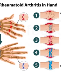 Joint & Bone Therapy Cream