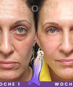 LEONA 2in1Kaviar Abschwellendes Augenmassagegerät