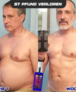 LIFTIC'X Gynäkomastie-Reduktionsspray