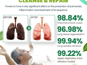 LungPurify™ Herbal Lung Cleansing Detox Ring