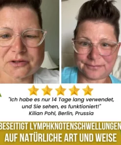 LympHeal™ Anti-Buckel-Ingwer-Salz