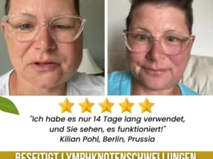 LympHeal™ Anti-Buckel-Ingwer-Salz