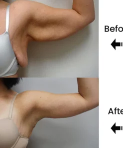 Lymph Nodes Herbal Detox Patch