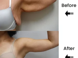 Lymph Nodes Herbal Detox Patch