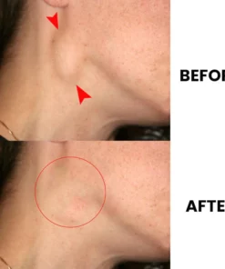 Lymph Nodes Herbal Detox Patch