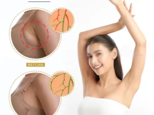 LymphDetox SwellReduce OrganicGinger Oil