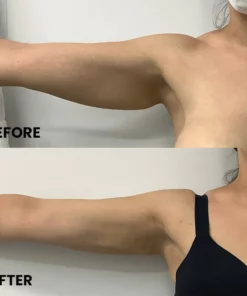 Lymphatic Detox Organic Ginger Soap