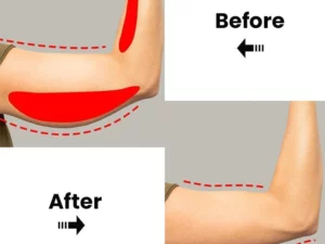 Lymphatic Detox Serum Roller