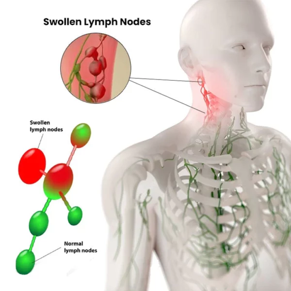 Rodillo de suero de desintoxicación linfática