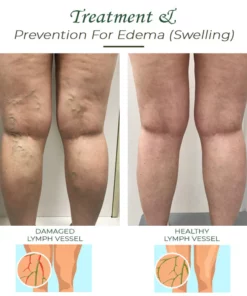 LymphaticDrainage DetoxGinger FootBath