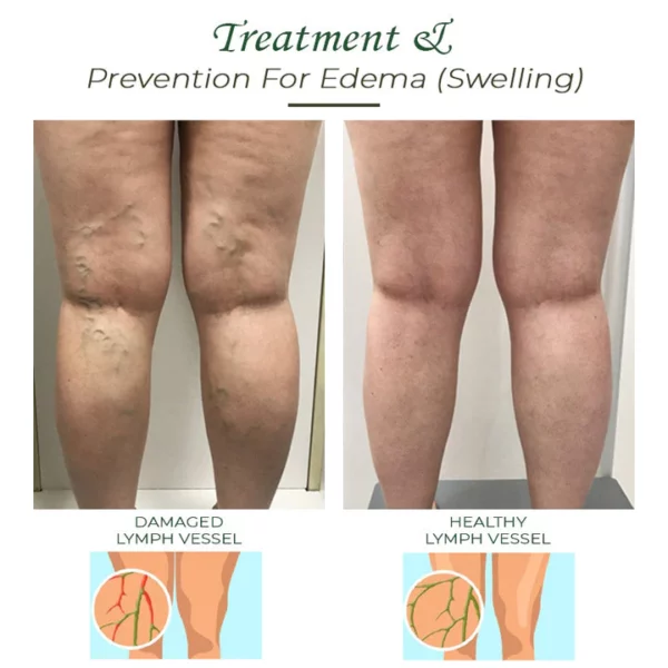 Lymphdrainage DetoxIngwer Fußbad