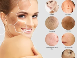 MA114™ Dark Spot Corrector & Anti-Aging Collagen Serum