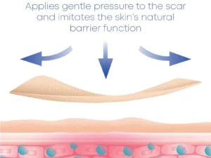 MEDVMA NonSurgical ScarRemoval SiliconTape
