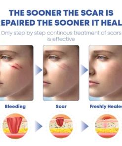 MEDVMA NonSurgical ScarRemoval SiliconTape