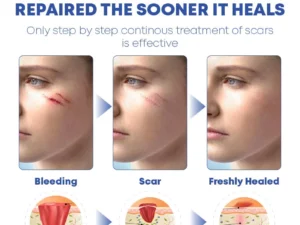 MEDVMA NonSurgical ScarRemoval SiliconTape
