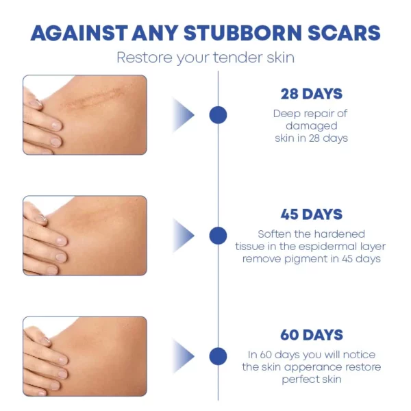 MEDVMA Non-Surgical ScarRemoval SiliconTape