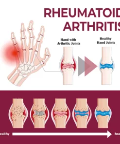 MEDix™ Joint & Bone Therapy Cream