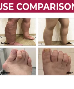 MEDix™ Joint & Bone Therapy Cream