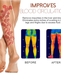 MediGinger AntiSwelling LympUnclog Ointment