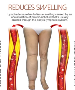 MediGinger AntiSwelling LympUnclog Ointment