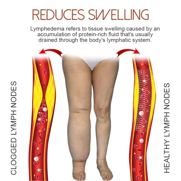 MediGinger AntiSwelling LympUnclog Ude