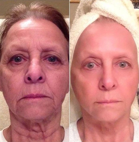 Medicubi Deep Vitamin C Ampoule - Image 7