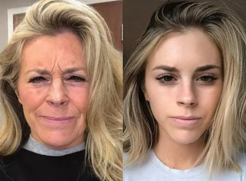 Medicubi Deep Vitamin C Ampoule - Image 6