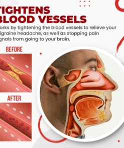 Migcare™ Migraine Relief Nasal Inhaler