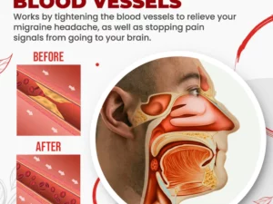 Migcare™ Migraine Relief Nasal Inhaler