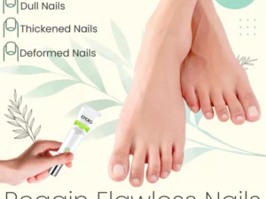 Nail Repair Treatment Gel