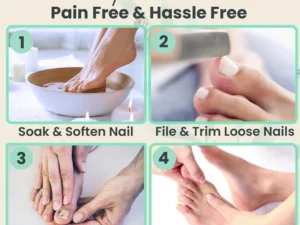 Nail Repair Treatment Gel