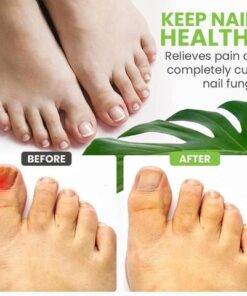 Nail Repair Treatment Gel