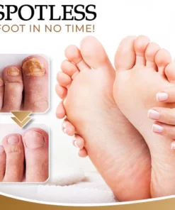 NailCure™ Anti-Fungal Foot Spray
