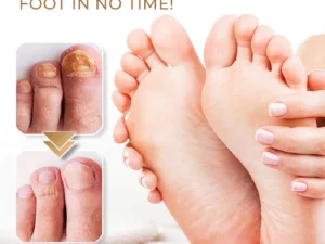 NailCure™ Anti-Fungal Foot Spray